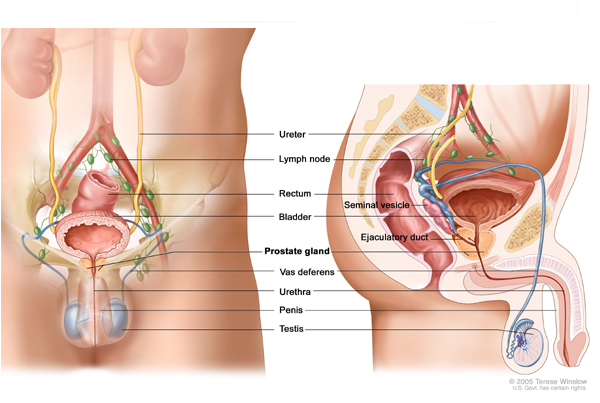 Prostate Cancer Surgery