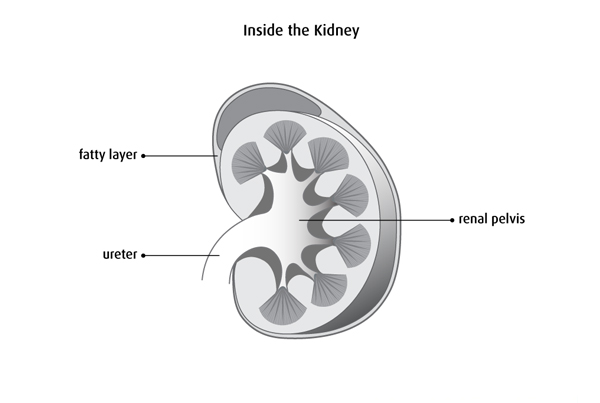 Ureteric Tumor Surgery