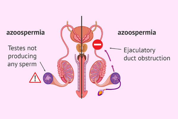 Andrology