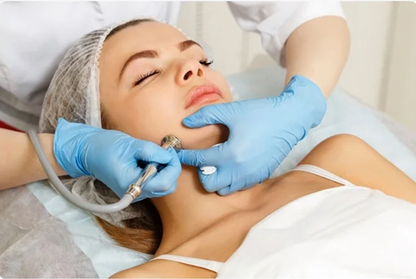 Dermabrasion