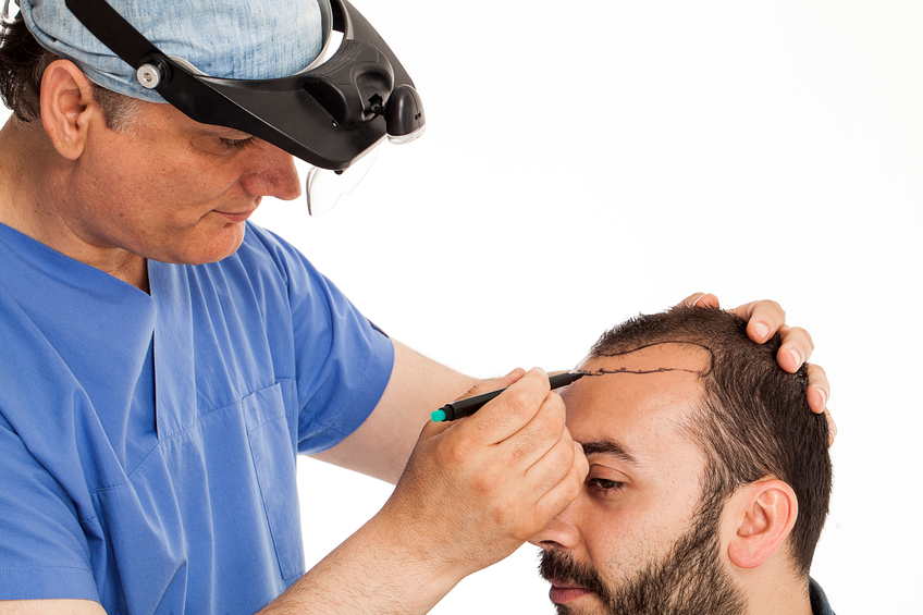 Best Hair Transplant Doctor