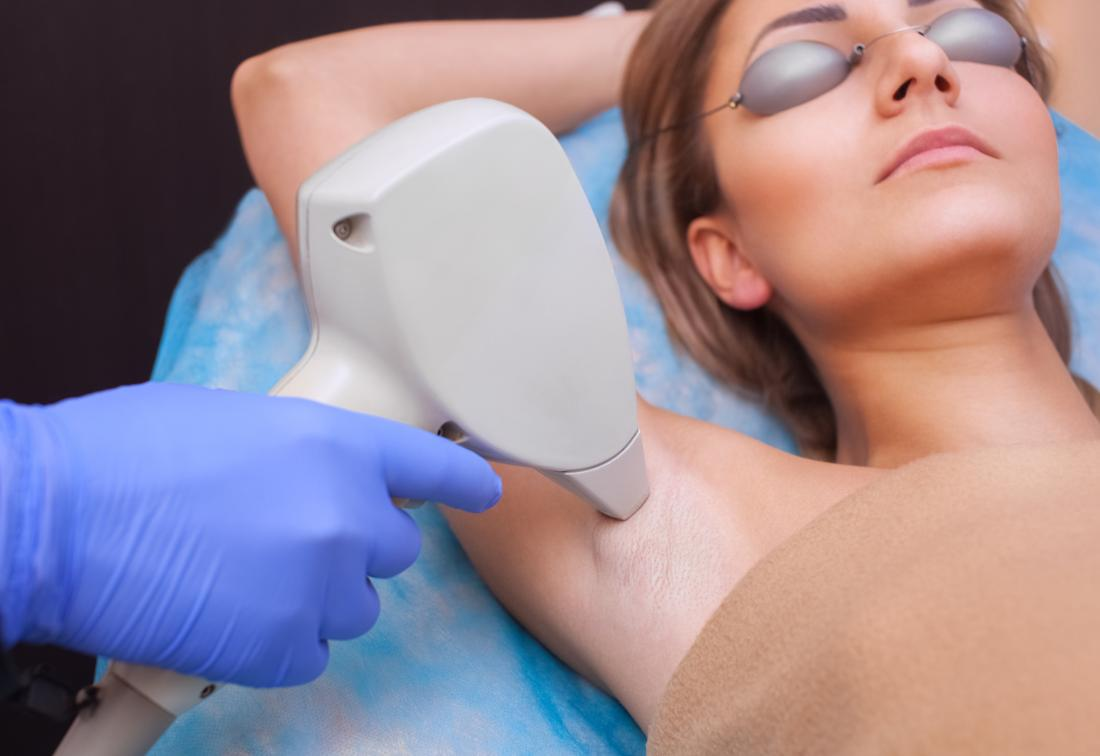 Best Laser Hair Removal