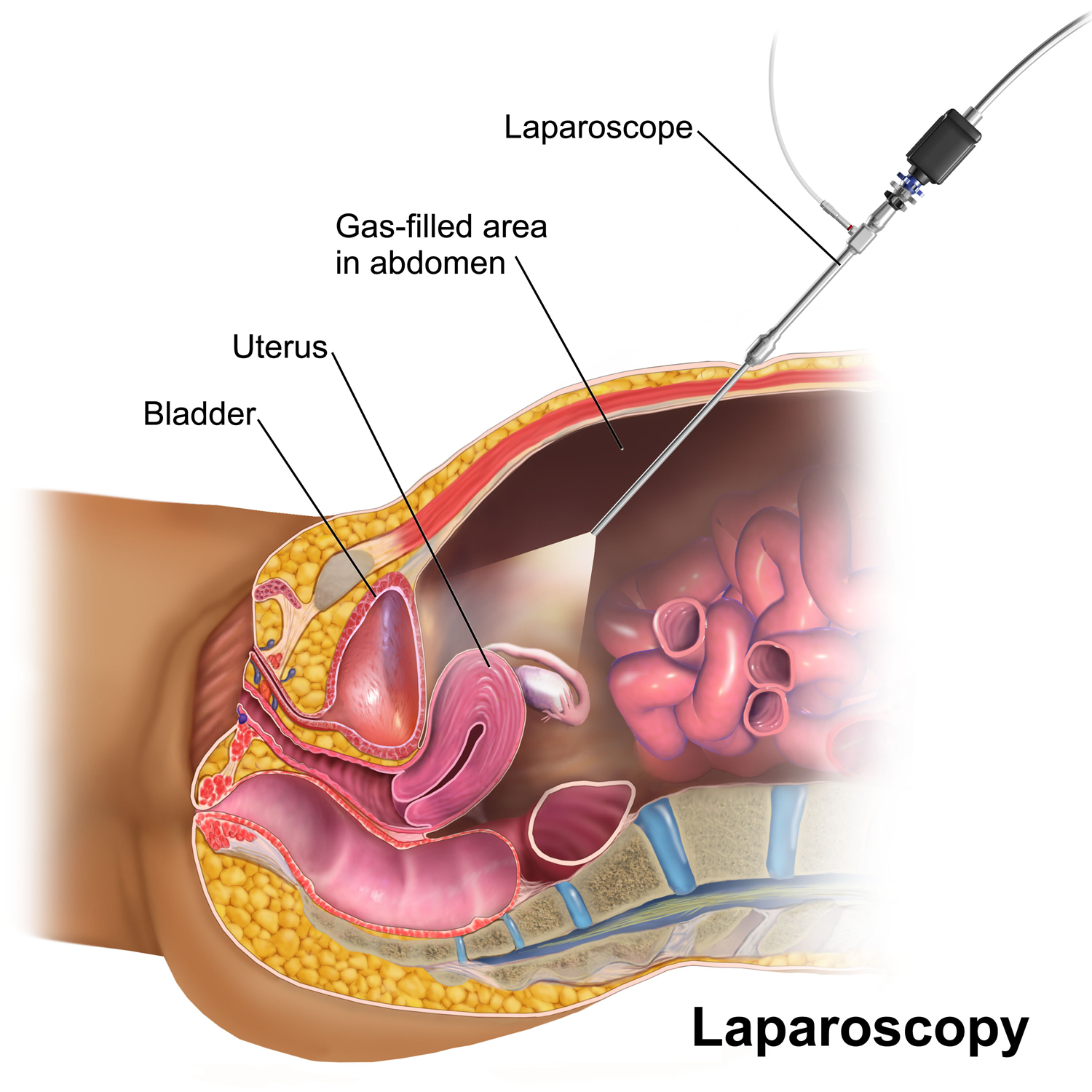 Laparoscopic Surgeon